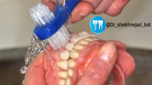  روش صحیح تمیز کردن دندان مصنوعی متحرک